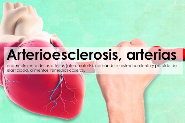 Arterioesclerosis, arterias