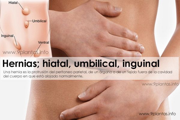 Hernias; hiatal, umbilical, inguinal