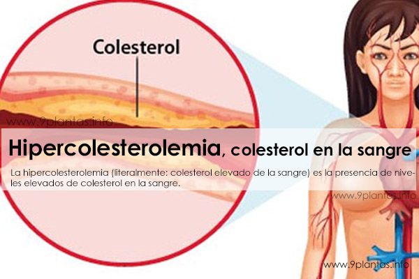 Hipercolesterolemia, colesterol en la sangre