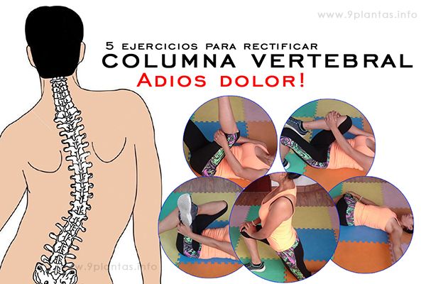 Dolor de espalda, ejercicios para rectificar la columna
